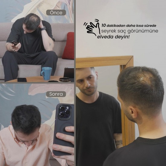 Batçı Saç Kapatıcı Dolgunlaştırıcı Sıvı Krem 30 ml